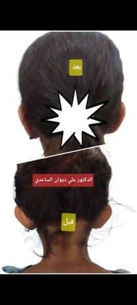 فحص مجاني الخميس • أخصائي أنف وأذن وحنجرة • العزيزيه شارع الاطباء