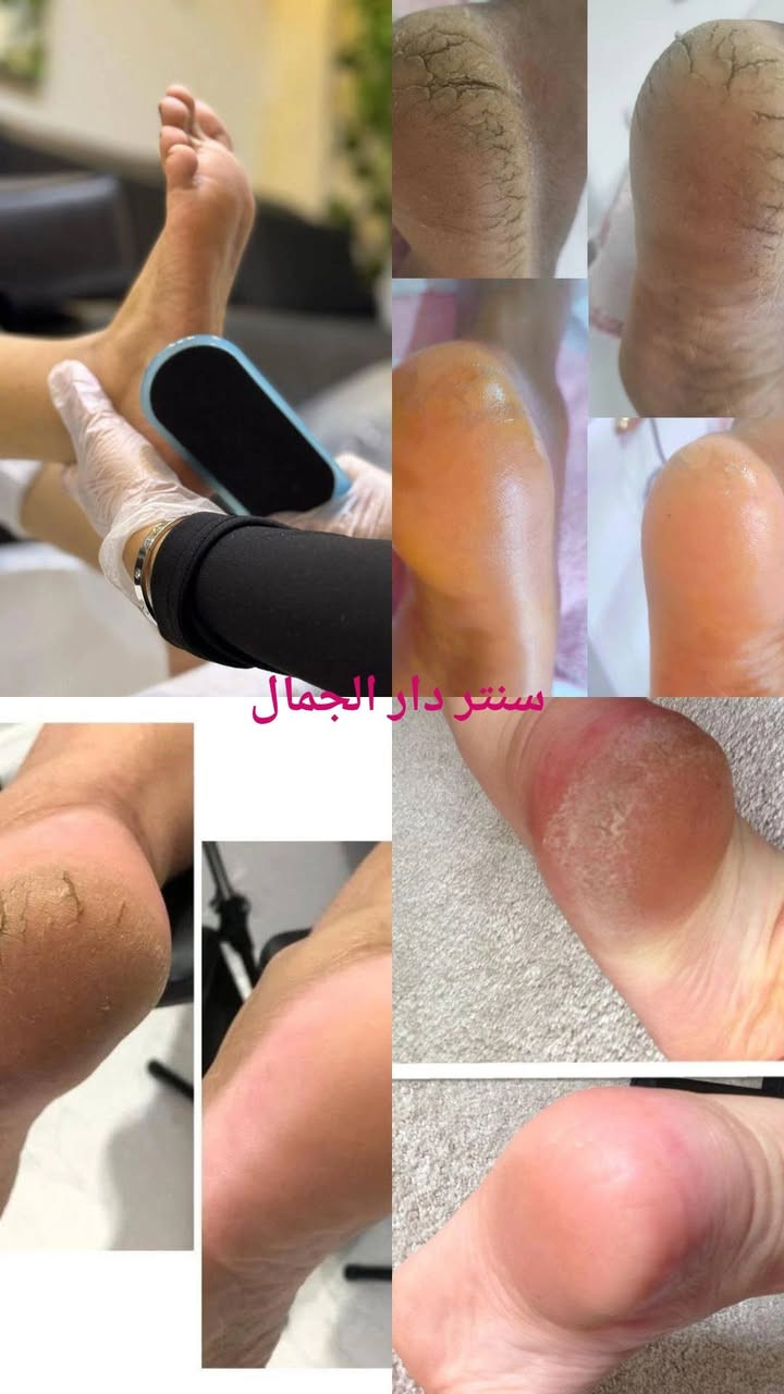 هلأ وسهلاً بكم بغداد العبيدي قرب سوق العبيدي فوق مصور زغاريد مقابيل صيدلية خضير سنتر دار الجمال *********** عروض لأول مره في سنتر دار الجمال تفليش كولشي بلاش
