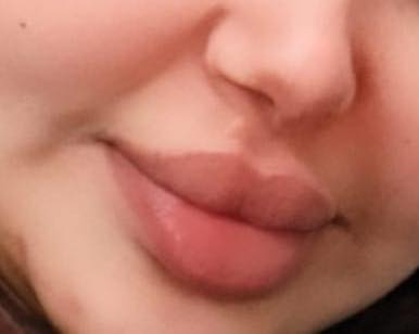 عيادة الدكتورة شذى عبد الامير للجلدية والتجميل شارع العمارة الحمرة مجاور معهد الشمس
ماكيره فاطمهام اسد@
