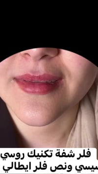 فلر شفة • فلر ايطالي • الكوت الهوره