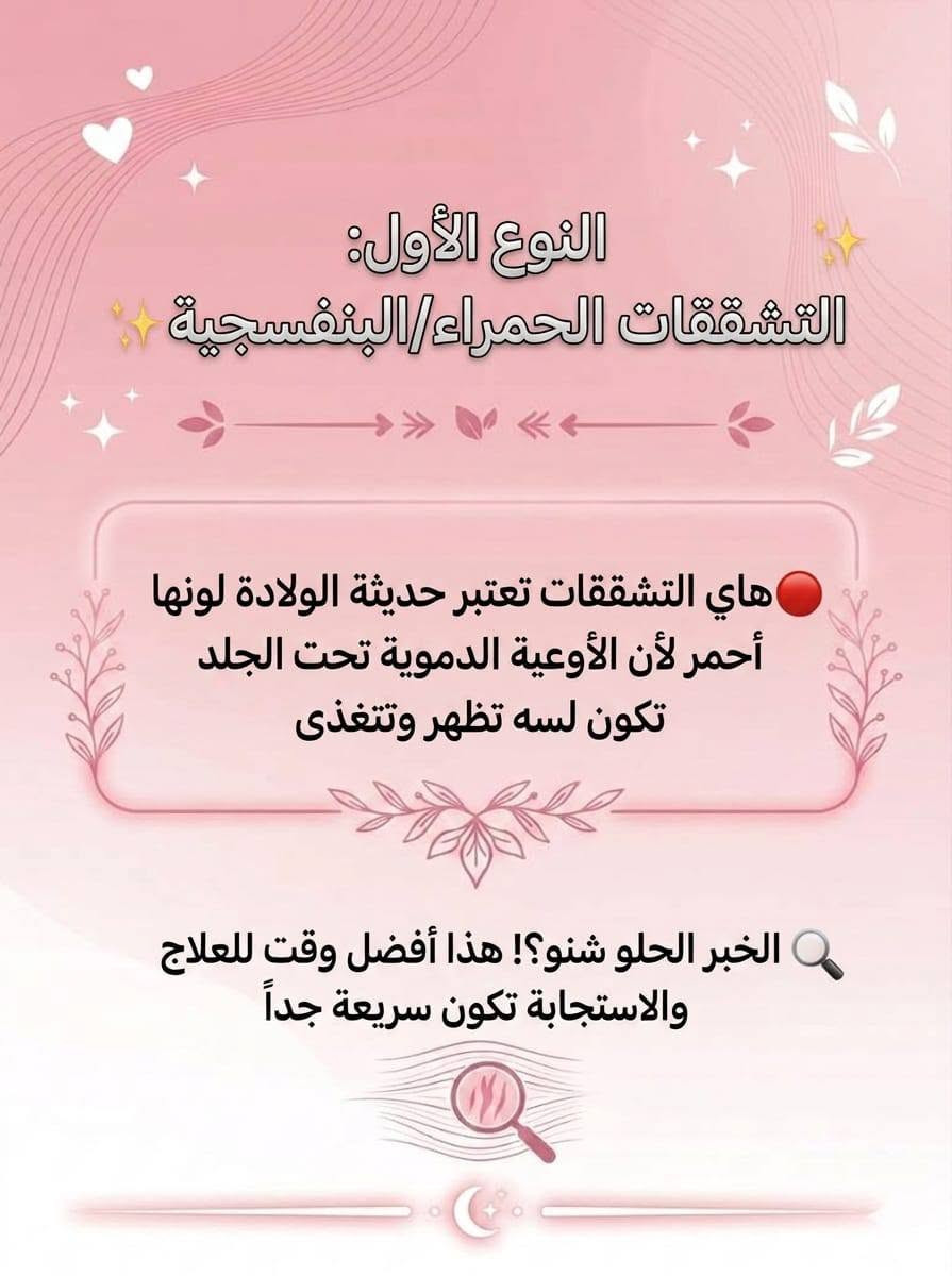 أسباب وعلاج تشققات الجسم 🩷
صيدلية متكاملة نوفر جميع انواع الادوية الاصلية ومنتجات العناية بالبشرة توجد خدمة توصيل لجميع محافظات العراق 🤍✨
#اكسبلور #استشارات #صيدلية #توصيل #skin_care


**إذا كنت صاحب هذا الإعلان وتريد حذفه لأي سبب، رجاءا أرسل رسالة إلى الدعم الفني**