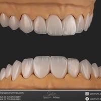 من الحالات التي تم انجازها من قبل مختبر سبيكترم من مميزات المختبر :  -...