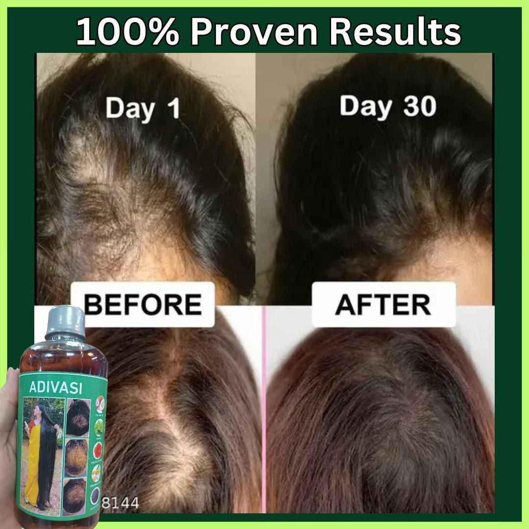 108 عشبة هندية.. يعني الحل الجذري لكل مشاكل الشعر! 🇮🇳✨
ليش زيت Adivasi مختلف عن أي زيت ثاني بالسوق؟
لأن تركيبته فريدة وتتكون من 108 عشبة طبيعية صافية! 🍃
يعني دتنطين شعرج فيتامينات ومعادن وعلاجات مكثفة بلمسة وحدة.
✅ يعالج الصلع الوراثي والتساقط الكربي.
✅ يثخن الشعرة ويمنع تكسرها.
✅ يطول الشعر بفترة قياسية.
✅ يرجع الحيوية للشعر التالف والمحروق.
دللي شعرج بخلاصة الطبيعة.. 💆‍♀️

صنع في الهند النجف, العراق


**إذا كنت صاحب هذا الإعلان وتريد حذفه لأي سبب، رجاءا أرسل رسالة إلى الدعم الفني**