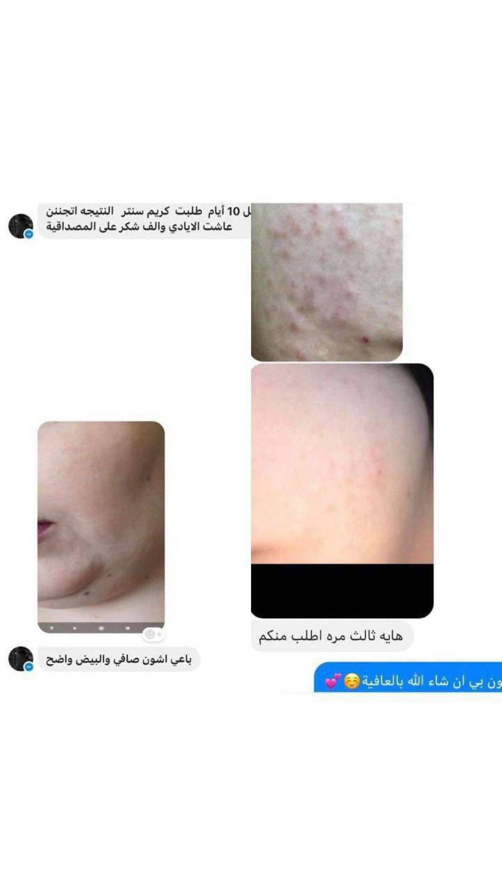 تريدون هيج بشرة صافية ؟
بشرة بدون مكياج وفلتر ؟ 
كريم كوين منتج مسجل ورسمي 
لعلاج مشاكل البشرة والتصبغات والكلف كريم كوين 
منتج كوين الاصلي

اطلب الان📩👇🏻


**إذا كنت صاحب هذا الإعلان وتريد حذفه لأي سبب، رجاءا أرسل رسالة إلى الدعم الفني**