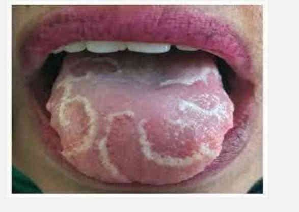 📍مجانا 
 سلام عليكم , الي عنده مثل هاي الحالات يتواصل ويايه نعالجها اله 
*العنوان / كربلاء الجمعيه خلف مول الحارث مجاور سيطرة الاحياء او كراج المخيم 
للحجز التواصل على واتساب  
* ***********

او الي عنده الم بمفصل الفك او طقطقه اثناء الاكل والكلام  او صعوبه بفتح الفم 
هم يتواصل ويايه
