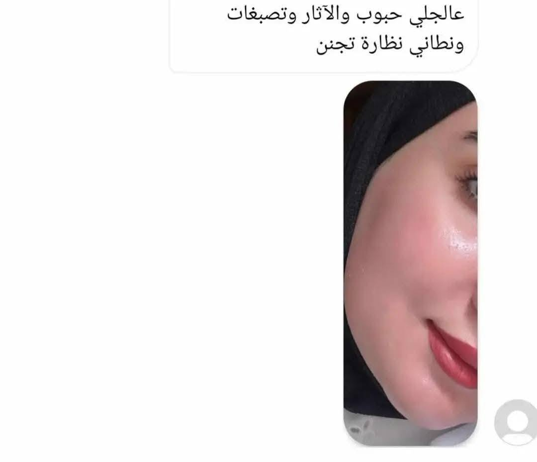 بنات عروض على جميع المنتجات تستمر يومين فقط لاحضو النتائج امانت الله يتوفر خدمة توصيل لجميع المحافظات


**إذا كنت صاحب هذا الإعلان وتريد حذفه لأي سبب، رجاءا أرسل رسالة إلى الدعم الفني**