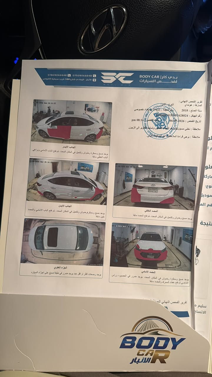 سلام عليكم لنتره خليجي سوبر موديل 2018سياره فول مواصفات عده البصمه بيه جاملغ وباب وسونار مرفوق السعر 135وبيه مجال ***********
