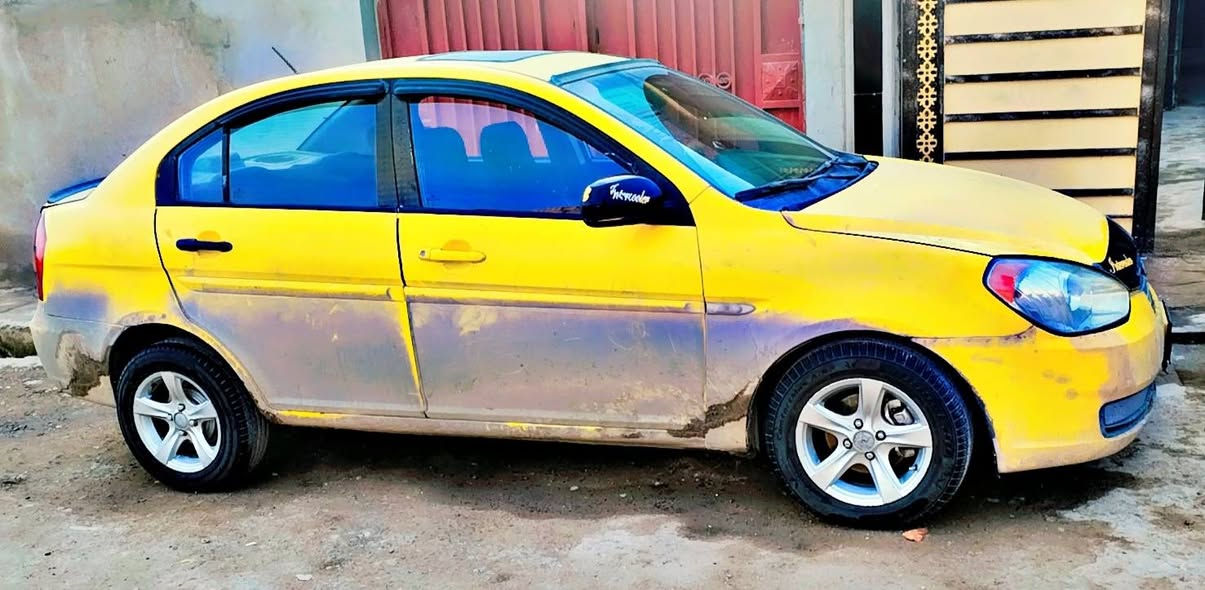 السلام عليكم اكسن 2010كوري فول عادي. كير شرط محرك بدايت صرف رقم نينوه هيه غرامات صفر ضرر خفيف خلفي بدون دواخل شرعي موجود بل موصل  مكان السياره موصل اليمن السعر. 75 (***********)
