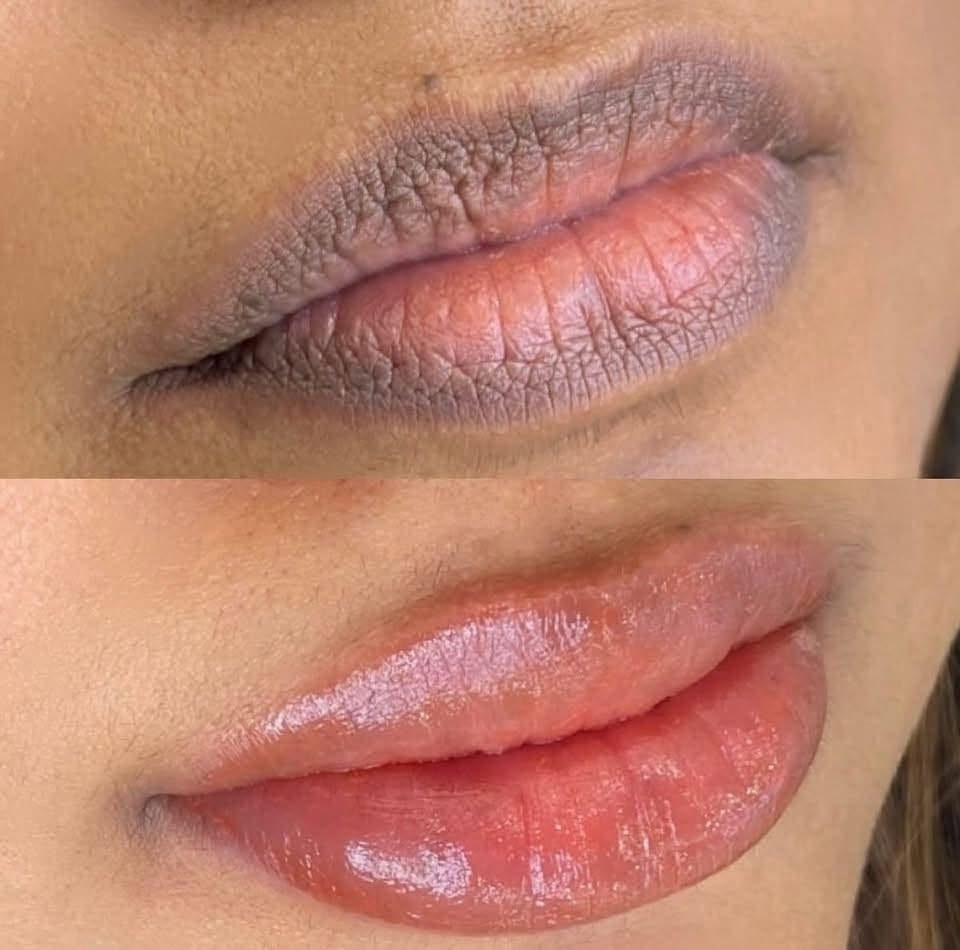 تلبية لطلباتكم سويتلكم عرض ع التوريد وتصحيح الوان الشفة.#. العنوان الديوانية العروبة. 

👄نوع الشفة الطبيعي اللي يكون بدون تصبغ. توريد بطريقة طبيعي60 الف اختيار لون نباتي. غير عضوي. 

👄توريد مع تحديد الشفة. باستخدام احبار نباتية غير عضوية. ب٧٥. 

👄توحيد لون الشفة. الزرقاء او السمراء بدون لون قوي فقط. توحيد اللون ب60 الف 

👄توحيد لون الشفة. الغامقه مع اضافه لون طبيعي. ب١٠٠. مع تحديد 
معادلة الالوان القديمة الموجودة في الشفه. ب٥٠ الف فقط 
العنوان الديوانية. العروبة. للحجز والاستفسار مراسلة البيج او الواتساب ***********
