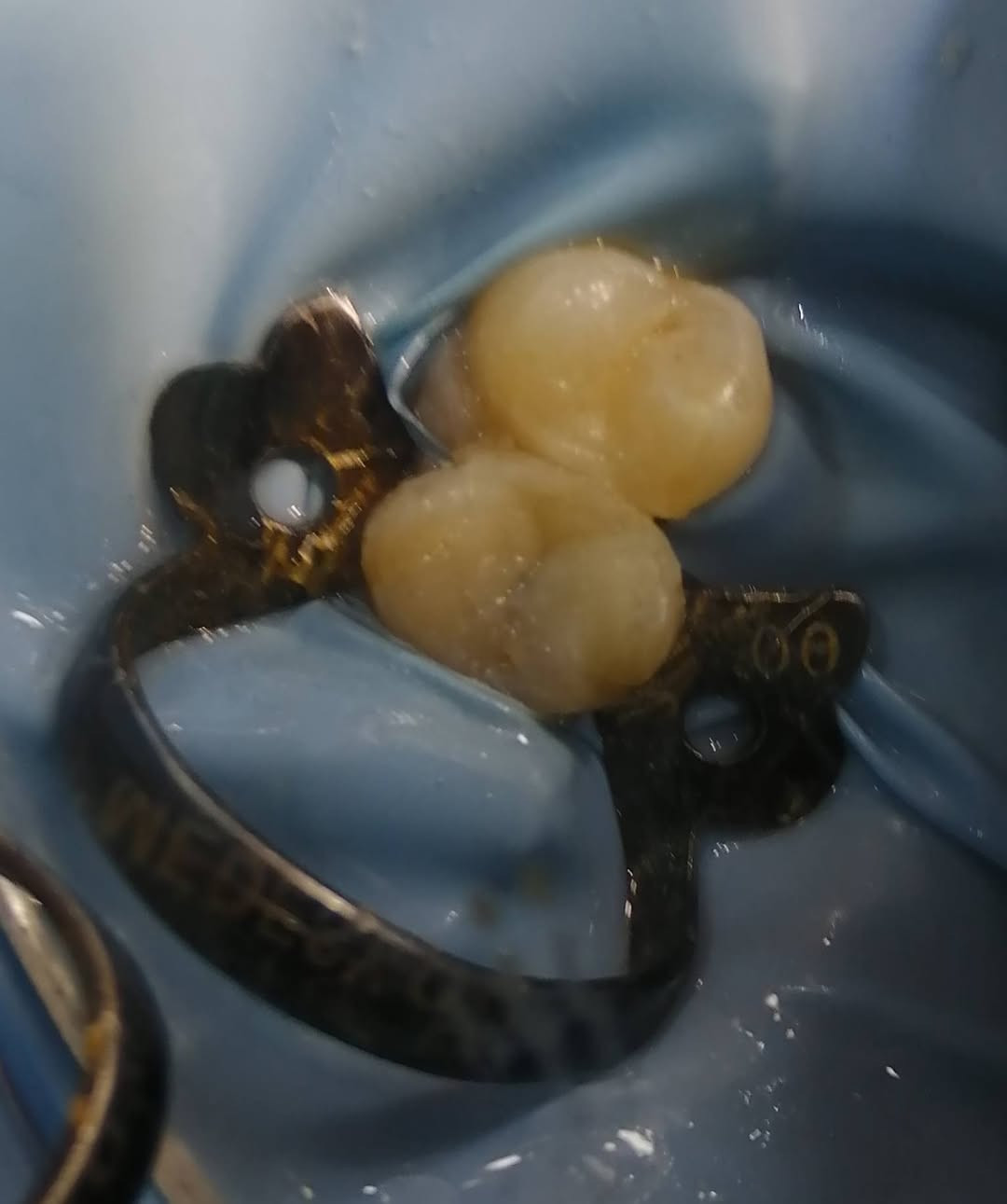 د مهند عبد الجواد الطحان الهاشمي.. ماجستير ودبلوم عالي تعويض الأسنان.. سايدين مستشفى #القيارهالعام.. للحجز والاستفسار التواصل على الرقم ***********# مجاور صيدليه عبدالله المعماري.. طابق ارضى
