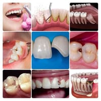 علاج أسنان مجاني • حشوات تجميلية • شارع المطار