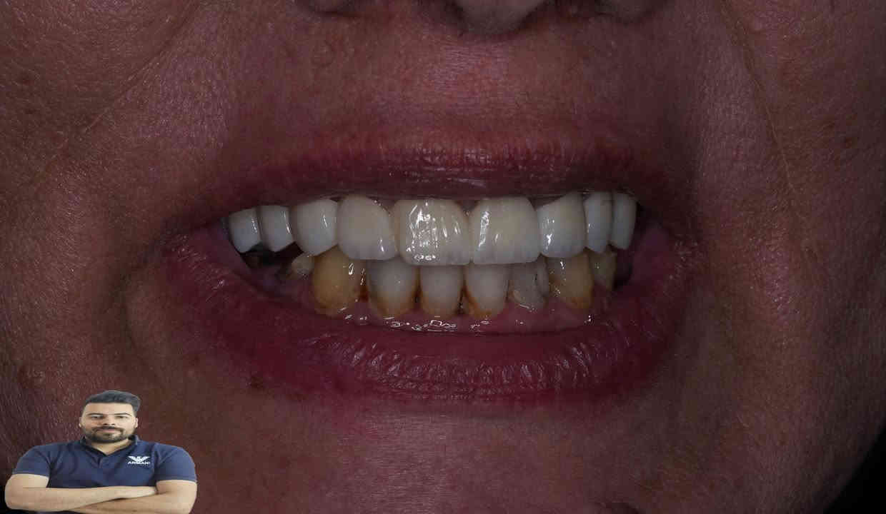 المراجعة مسوية تركيب بغير عيادة وماعاجبهة الشغل اجتي عادتة يمنة وكانت هاية النتيجة

العنوان / المسيب / شارع البلدية / مقابل دكتور جعفر وفي للاطفال/مجاور عالم الحليب

للحجز والاستفسار
***********
***********
