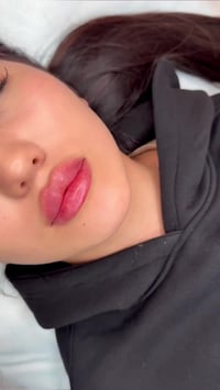 🫡 عروض وتخفيضات هائلة 🏩 في مركز ناز بيوتي سنتر  NBC للعمليات التجميلية...