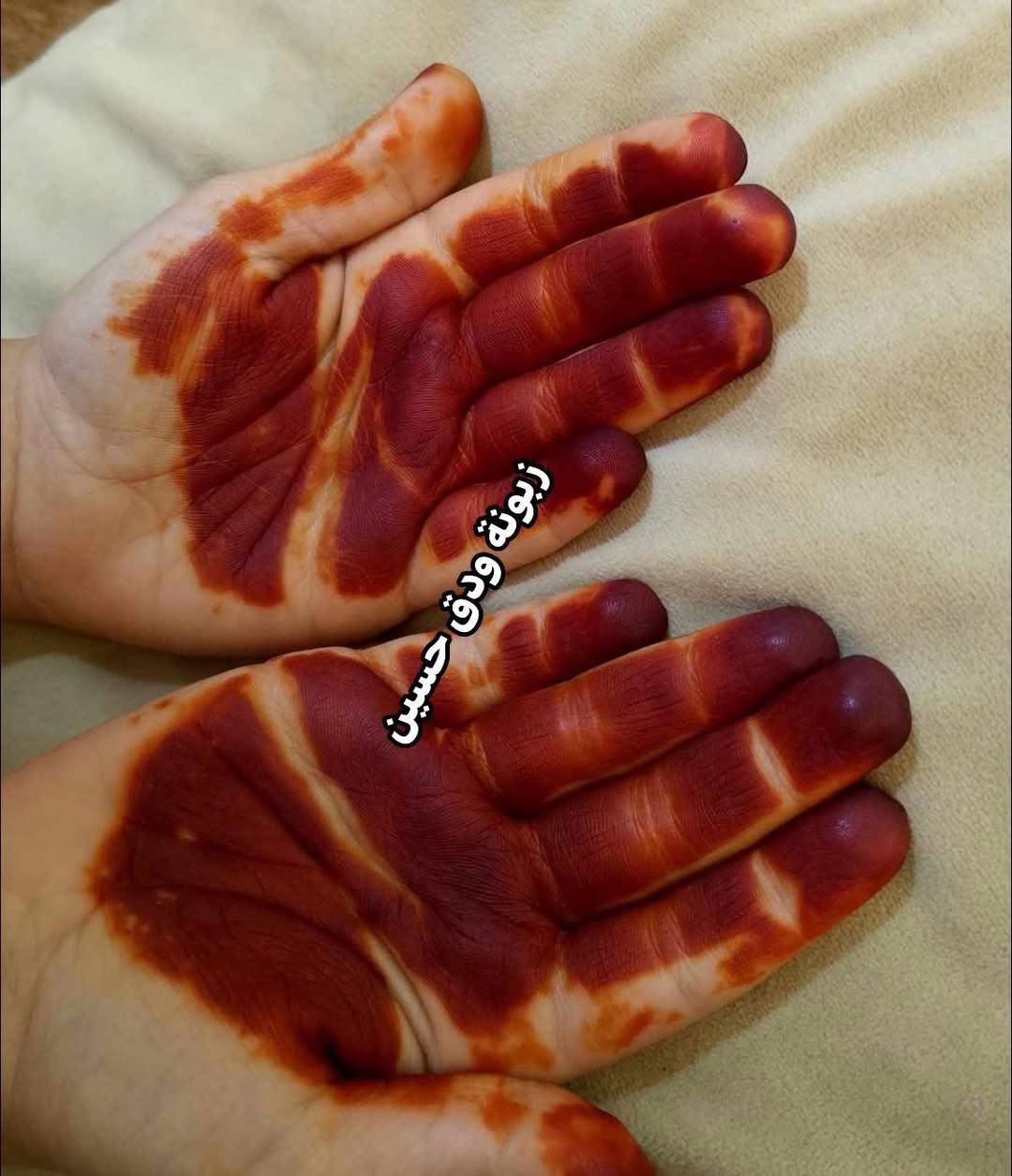ممكن متابعه للبيج 🥹 فضلاً وليس امراً ❤️


**إذا كنت صاحب هذا الإعلان وتريد حذفه لأي سبب، رجاءا أرسل رسالة إلى الدعم الفني**
