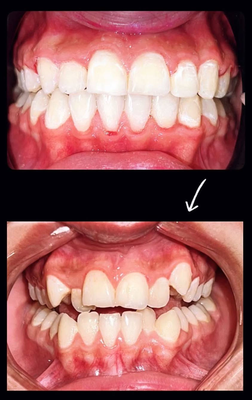 عروضض تكسر الدنيا لاهل الحسينيه وللناس الي تحتاج تسوي تقويم ومحتاره
عيادة السلام التخصصيه توفر لكم 
عرض التقويم فك الواحد ٤٥٠ الف وبالاقساط المريحه لعوائلنا الطيبة وباحسن النتائج 
شغل الطبيب راح ارفقه بالبوست 
*********** للحجز واتساب راسلوهم ومايقصرون وياكم ..
العنوان 
حسينية مدخل ثالث مقابيل بركر موسى 
مجاور صيدليه الطاقه الدوائيه.
