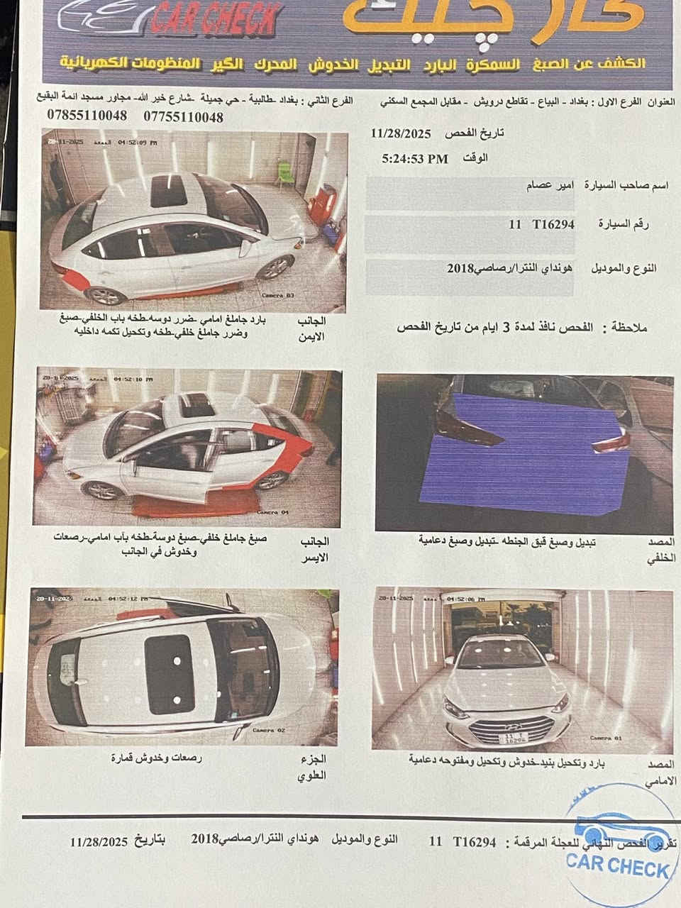 السلام عليكم 
النترا 2018 محرك 2000 دوش كير ATبلاد 
السياره فول الأخير 
بصمه 
فتحه 
بصمه أبواب 
باتري جديد صار أسبوع من شاده 
محرك خير من الله تبريد ثلج 🧊 تدفئه 
السياره مدوشمه بل كامل 
رقم بغداد الجديد تحويل مباشر السياره جاهزه من كلشي ربع متصرف عليها مال جناي حادث خلفي موضح بل صوره 
ماشيه 95mi
العنوان بغداد الشعب 
السعر 130 
رقم تلفون 
***********
