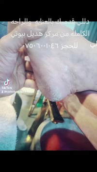 👇 🔥✨ أقوى عروض الجمال في مركز هديل بيوتي ✨🔥 🌟 دلع كامل من راسج لرجليج ...