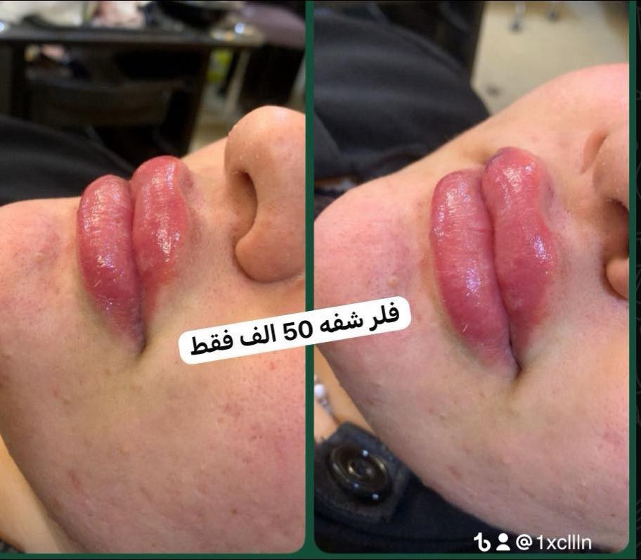 مرحبا 👋
راح اقدملكم عروض اجنن لمدت اسبوع فقط زبوناتنه الحلوات  سارعو بلحجز
حنه +عرس 150الف فقط مع هديه  للعروس اضافر حفافه تنضيف بشره تنضيف قدم معالج للشعر ❤️👰
مهر 50الف  هديه للعروس تنضيف بشره حفافه تنضيف قدم ❤️👰
مدعوه مكياج شسوار 30 الف فقط مع رموش هديه 👸
اكرلك 25الف 
جلش 15
كل انواع التاتو 25
مايكرو 
امبري
مسح حاجب مجاني مع ابرت تخدير مجاني 
تنظيف عميق بلهايدرو فشل ملكي مع ابرت الكولايجن 20الف 👍
تنضيف بشره بلجهاز الماسي مع ماسكات وبخار 15 الف 
تنضيف بشره عادي مع ماسكات 15
توريد شفه25مع تثبيت الون
تنظيف قدم ملكي مع بكج القدم 10🦶🏻
قص الشعر مع غسل ومعالج 10💇‍♀️
شسوار مع غسل ومعالج 10
عروض لمدا محدوده ❤️  
اكرلك مع دزاين مجاني25
حفافه مع شمع  مع تنضيف بشره 10❤️
قسم الشعر 💇🏼‍♀️
صبغ جذر 15 🙍‍♀️
صبغ  كول انواع الشعر 25بدون قصر
تخصيل  بلسلفون  مع صبغ شعر قصير 50الف
مع معالج هديه
تخصيل بلسلفون  مع صبغ وسط 75 مع معالج هديه
تخصيل شعر طويل للخصر  مع صبغ بلسلفون اسلايتات او تشطيب حسب طول الشعر او ثخنه ونشالله منقصر وياكم بلسعار   مع قص معالج هديه
تسريح الشعر وبضمان ونتيجه اكيد راح تعجبكم  ولسعر انشالله منقصر وياكم حبايب
معالج الشعر القصير فقط20الف 
معالج  الشعر المتوسط20
معالج الشعر الطويل 25🙂
رموش دائميه 25❤
رموش طرفيه 15  
حمام مغربي  مع سقله المغربيه مع تقشير الجسم 25 
تركيب شعر طبيعي كول لون او سعره او كول قياس او سعرا وسعارنا جدا تنافسيه 🙅‍♀️يدللون علينه الحلوات 😇
لـكل جـمآل عنوان وحنه عنوانه نونه بيوتي للتجميل تنورونا راح تلكون كوادرنه ابخدمتكم تحياتي الكم  العنوان الدوره حي  الصحه  الشارع الرئسي  المدخل الاول لحوم عقيل فرع المولد المدخل الثاني فرع سنتر الصحه المدخل الثالث فرع صيدلية  الشفاء المعروفه بصيدلية مصطفى  ***********
☝🏻
