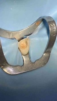 كربلاء المقدسة • علاج اسنان مجاني • عوائل متعففة