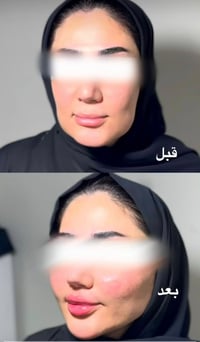 عيادة سنايا • كربلاء الجمعية • فلر بوتوكس