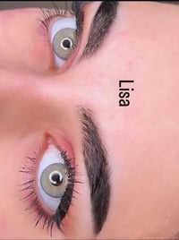 عدسات طبيعية سنوية • قطر ١٤٫٢ • جملة ومفرد