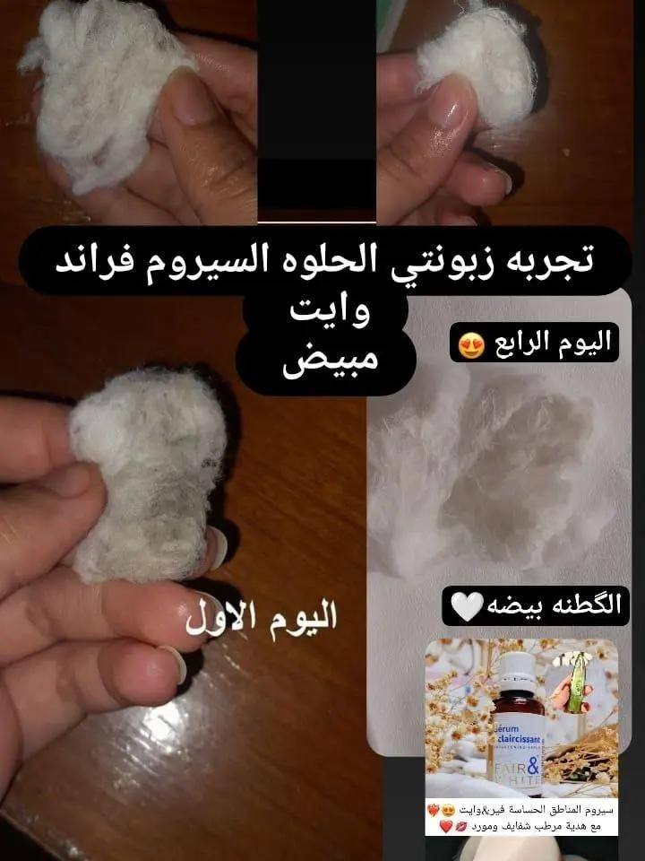 عرض خاص للمناطق الحساسة
الاصلي وبس يمنه انتبهوا على تفاصيل علبة السيروم الفرنسي 🇫🇷 اليوم عرضنا للعرايس والمتزوجات سيروم  العناية بالمناطق الحساسه وبالجسم كامل
للي عدهة اسمرار بالمنطقة الحميمية والكوع والمفاصل أو تصبغات بالجسم راح يكون هذا الحل الأنسب الج 💗
للاستفسار خاص بغداد, العراق


**إذا كنت صاحب هذا الإعلان وتريد حذفه لأي سبب، رجاءا أرسل رسالة إلى الدعم الفني**