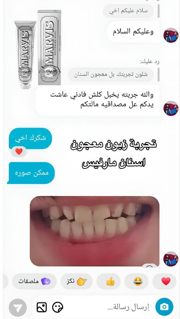 معجون أسنان مارفيس سموكرز وايتنينج منت بالنعناع 🍃 (Marvis Smokers Whitening Mint).  ❄🫢 فعال في إزالة البقع الناتجة عن القهوة والشاي وأصفرار الأسنان لدى المدخنـين ‼️
🪞 يحتوي على تركيبة خاصة من البوليمرات المقاومة للبقع.
🪞 يعمل على إزالة البقع السطحية والجير، ويمنع تسوس الأسنان.
🪞 يتميز بنكهة النعناع المنعشة التي تمنح إحساسًا بالنظافة.
فـوائدة :
- يزيل تلون الأسنان الناتج عن التدخين والشاي والقهوة
- يمنح طعم النعناع المنعش
- يحارب تكون الجير وطبقة البلاك
- يمنع تسوس الأسنان
متوفر في عبوة بحجم 85 مل.
المنتج خالٍ من البارابين والغلوتين!
المنشأ / بريطانيا 😎
﹏﹏﹏﹏﹏﹏﹏﹏﹏. 🩷⋆˚🧁✧˚.🎀


**إذا كنت صاحب هذا الإعلان وتريد حذفه لأي سبب، رجاءا أرسل رسالة إلى الدعم الفني**