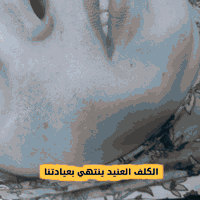 تصبغات البشرة • علاج الكلف • عيادة روما