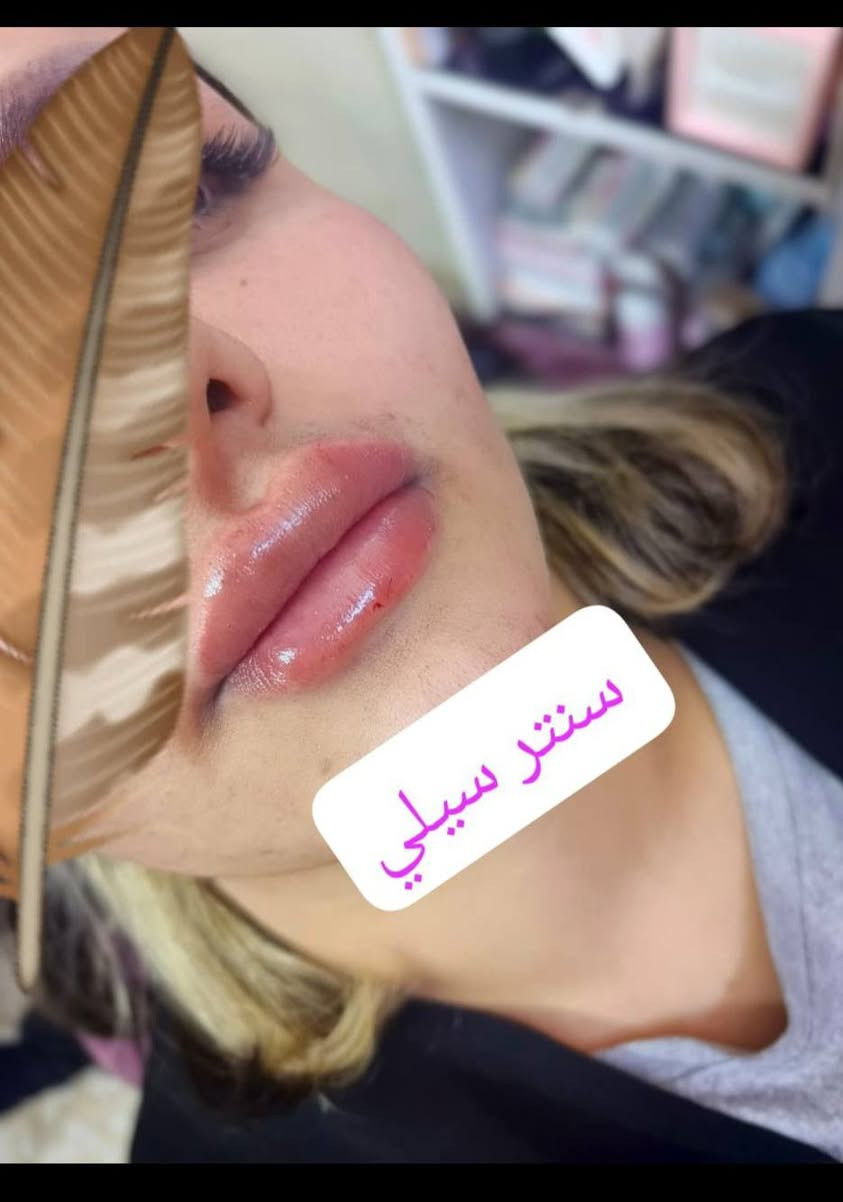 عروض سنتر سيلي موجوده يوميه من12 الضهر للسحور @إشارة


**إذا كنت صاحب هذا الإعلان وتريد حذفه لأي سبب، رجاءا أرسل رسالة إلى الدعم الفني**