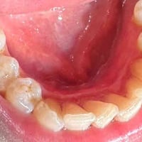 تكلسات • عمل مجاني • الحله شارع 40