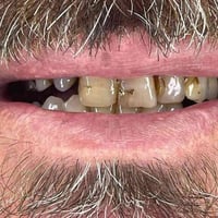 مختبر أسنان • تعويضات سنية • خدمة منزلية