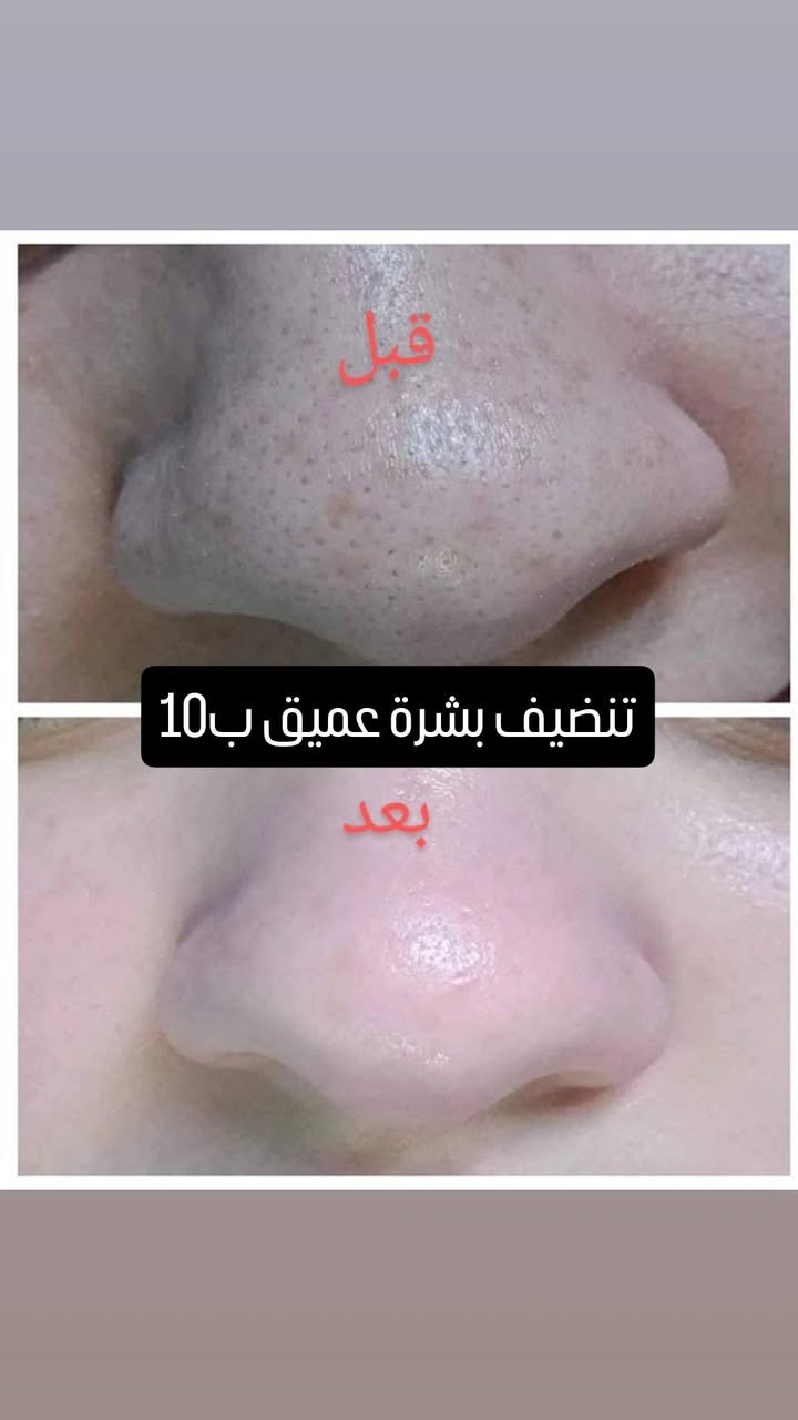 عروض صالون النجووم


**إذا كنت صاحب هذا الإعلان وتريد حذفه لأي سبب، رجاءا أرسل رسالة إلى الدعم الفني**