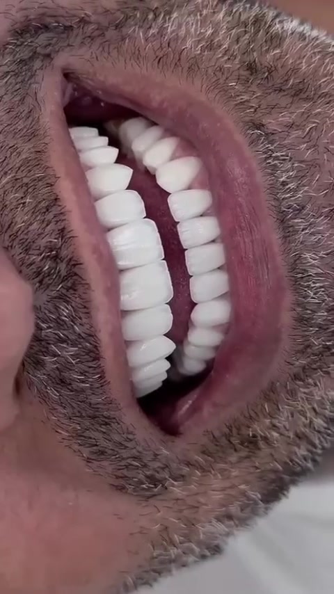 "🦷 أسنان صحية وابتسامة مشرقة...

في مراكز الشركة الطبية العالمية ، نوفر لك أحدث تقنيات طب الأسنان، وأسهل طرق الدفع.

✅ تقويم الأسنان ✅ تبييض الأسنان ✅ ابتسامة هوليوود
زراعة أسنان 
وحشوات وكتير من الخدمات 

متواجدين داخل المركز طيلة أيام الأسبوع لخدمتكم 

  #عيادة_اسنان #طب_اسنان #كي_كارد #KeeCard #دفع_الكتروني تقويم_اسنان تبييض_الاسنان زراعة_الاسنان ابتسامة جمال صحة

🔻
🏢 العنوان / بغداد _ الزعفرانية  الاربع شوارع _ مجاور مدرسة الاميرات ..
📲 للحجز والاستفسار 
***********
مركز_سما_الزعفرانية_لطب_وتجميل_الاسنان
