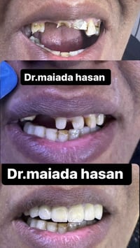 عروض على قسم الاسنان في عيادة الدكتورة ميادة حسن لطب وتجميل الاسنان ال...