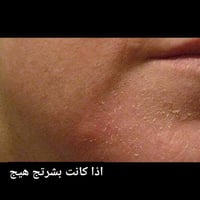 تفتيح • ترطيب عميق • بشرة جافة سمراء