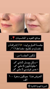 عروض عيد الاضحي • حجز • الدورة المهدية الثانية