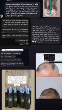 يثخن الشعر • يطول الشعر • من أول أسبوع