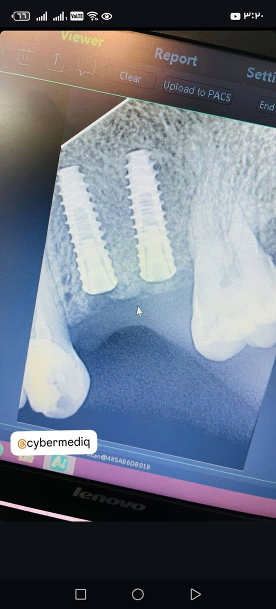 عياده دكتور علي القريشي 
زرعة عيادة الدكتور علي كاظم القريشي لطب وزراعة وتقويم وتجميل الأسنان 
بالاقساط 
***********
