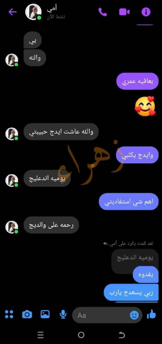 الف رحمه على روح امه وابوه اليعلقلي هذا مصدر رزقي الوحيد #يارزاق 🤲
خلطة بشرة تجنن تسوي الوجه گيمر 
طبعا تستخدم للرجال ونساء 

#خلطه عباره عن سيرومات مابيه اي مضره  شغلها يخبل  وفوائده تجنن على بشره 

تعالج مشاكل البشره #تصبغات_اسمرار_كلف_حبوب_نمش يعني هي تساعد البشره تعيد حيويته تنطيه نضاره وتبييض طبيعي النتائج من اول 3 ايام يبين الفرق 

للحجز مراسله الخاص
او واتساب *********** الرمادي, الأنبار
