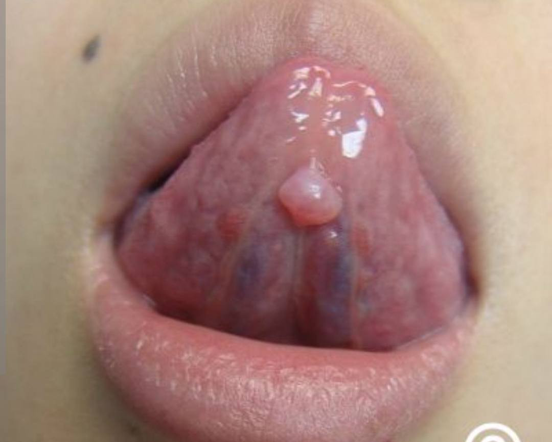 السلام عليكم
أنا طالب ماجستير في جراحة الفم  - كلية طب الأسنان 
   

يقدم فرع جراحة الفم والفكين بالكلية الخدمات الآتية 

قلع الأسنان وأضراس العقل المنطمرة  جراحيا 
زراعة الأسنان  
و متابعة أي حالة مرضية بالفم والفكين  وإزالتها جراحيا 

من لدية الحالات المذكورة   التفضل بالتواصل على الرقم 
***********     (واتساب)

تقدم الخدمات بأسعار رمزية
