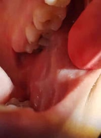 الي يحتاج حشوة ضوئية تجميلية يتواصل معي 07712569165 العنوان بغداد باب ...