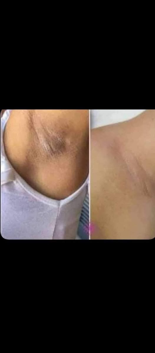 كريم مبيض فعال لجميع الجسم 🥰
شوف الفرق من أول أسبوع 😍😍
السعر العلبه ١٥🤩🤩🤩🤩
التوصيل مجاني للجميع المحافظات  القضية 🚗🚗🚗


**إذا كنت صاحب هذا الإعلان وتريد حذفه لأي سبب، رجاءا أرسل رسالة إلى الدعم الفني**
