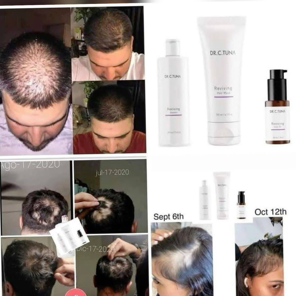 *زيت #الثوم من د سي توناFRMASI* 

⭐يُسهم في تقوية نمو الشعر، وزيادة بصيلاته، وبالتالي الحدّ من مشكلة تساقطه. 
⭐يحتوي على كثيرٍ من المعادن والفيتامينات المُغذّية للشعر، والتي تزيد من ترطيبه وكثافته ولمعانه. 
⭐يُساعد على تنشيط الدورة الدموية في فروة الرأس وزيادة نمو الشعر فيه لأنه يحتوي على مركب الأليسين. 
⭐يُساعد على حماية فروة الرأس من القشرة، والتخلّص منها. 
⭐يحتوي على فيتامين C الذي يُساهم في المحافظة على صحة الشعر ولمعانه.
⭐يقوّي جذور الشعر ويزيد من كثافتها. 
⭐يُساهم في علاج #تقصّف الشعر. 
⭐يعد مُعالجاً جيداً لجفاف الشعر. 
⭐يُساهم في زيادة #طول الشعر وسماكته.


**إذا كنت صاحب هذا الإعلان وتريد حذفه لأي سبب، رجاءا أرسل رسالة إلى الدعم الفني**