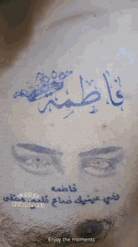 وشم • ازالة وشم • الرمادي التاميم