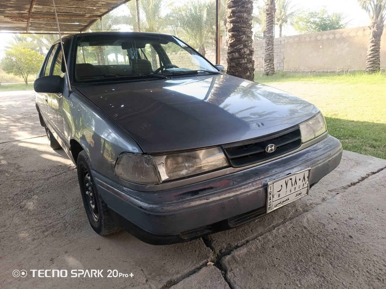 السلام عليكم للبيع
هونداي  اكسنت 

موديل  93

رقم بغداد بسمي تحويل مباشر مشروع وطني

السياره عله وضع الشركه بلاديه قطره صبغ مابيه

تبريد شغال ثلج شرط

كير ومحرك مكفول 

صدر خلفي امامي جديد 

تخم تاير باتري جديد 

كهربائيات كله شغاله عله وضع الشركه 

السياره جاهز مابيه اي نقص ترايك وين مايعجبك

مكاني بغداد 

السعر  29

***********
