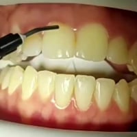 عيادة لؤلؤة بدرة • تبييض اسنان • ابتسامة جذابة