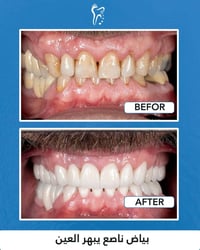 سماوه تقاطع الباني • تقويم أسنان • زراعة أسنان