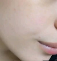 خلطة إيرانية • تزيل الكلف • خاص بنات