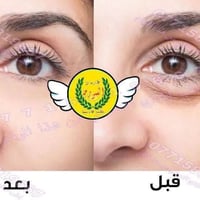 منتجاتنا من خلاصة الاعشاب فقط 🍃 واتساب 07703894663