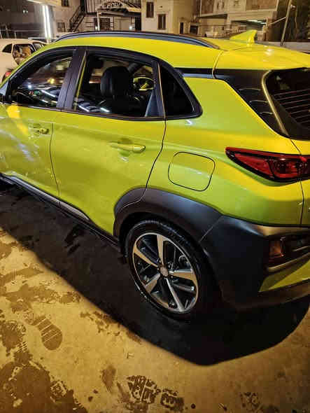 السلام عليكم سياره كونا للبيع 2019 ماشيه 65 سياره حلو ونضيفه وارد امريكي فول سياره بصمه فتحه بل سكف رادار مانع نزلاق بيه قطعتين جملغ وشويه من البنيد صور حادث بل منشور مكاني بغداد شهداء البياع السعر 137وبيه مجال بسيط الرقم ***********
